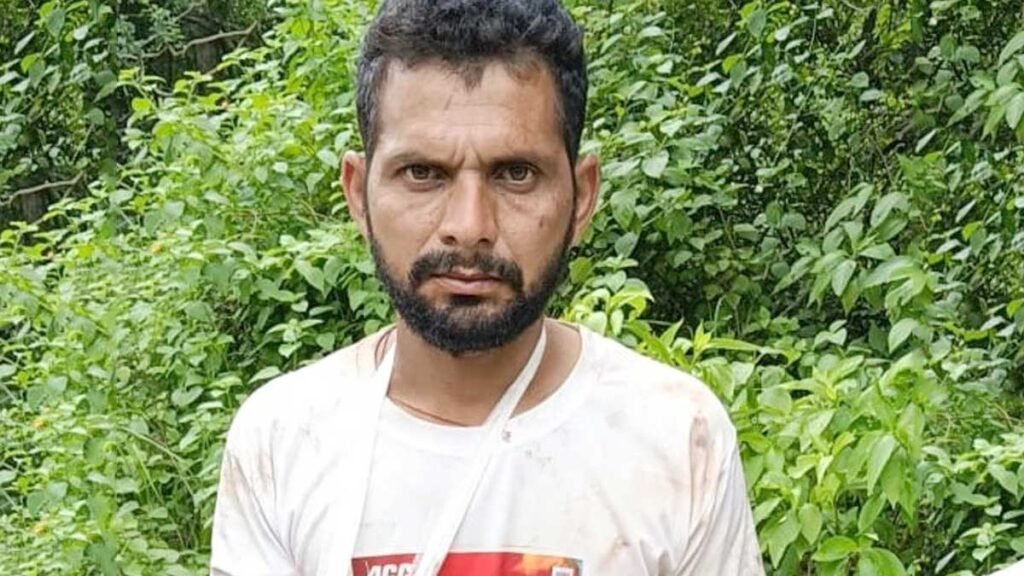 हाथ और कंधे पर पंजों के निशान