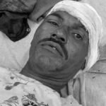 rampur crime friend bit ear over 200 rupees dispute
