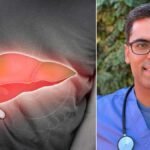 fatty liver exercise to reduce liver fat naturally